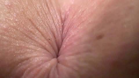 3161